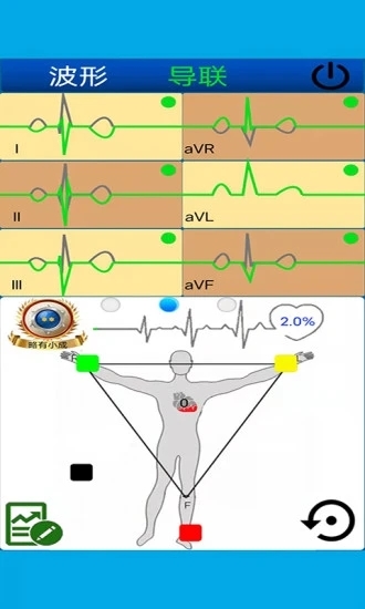 心电图计算器2023安卓版下载